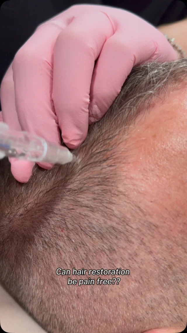 Who said hair restoration has to hurt?
Get ready to love your hair again!

JetPeel Hair Restoration with Exosomes delivers powerful growth factors 1.4mm deep into the scalp without a single needle! 

✔️ Thicker, fuller hair
✔️ Stronger, healthier follicles
✔️ Less shedding, more confidence
✔️ NO pain, NO downtime

*Link in bio to book*

Visit our website at ministryofskin.ca and join our newsletter for exclusive promos!

#HairRestoration #JetPeel #Exosomes #HairGrowth #ScalpHealth #CalgaryHairClinic #YYCHair #yycskin #CalgaryMediSpa 

advanced skincare, medical aesthetics, skin treatment, skin tightening, non-invasive, skin rejuvenation, Calgary medispa, latest technology